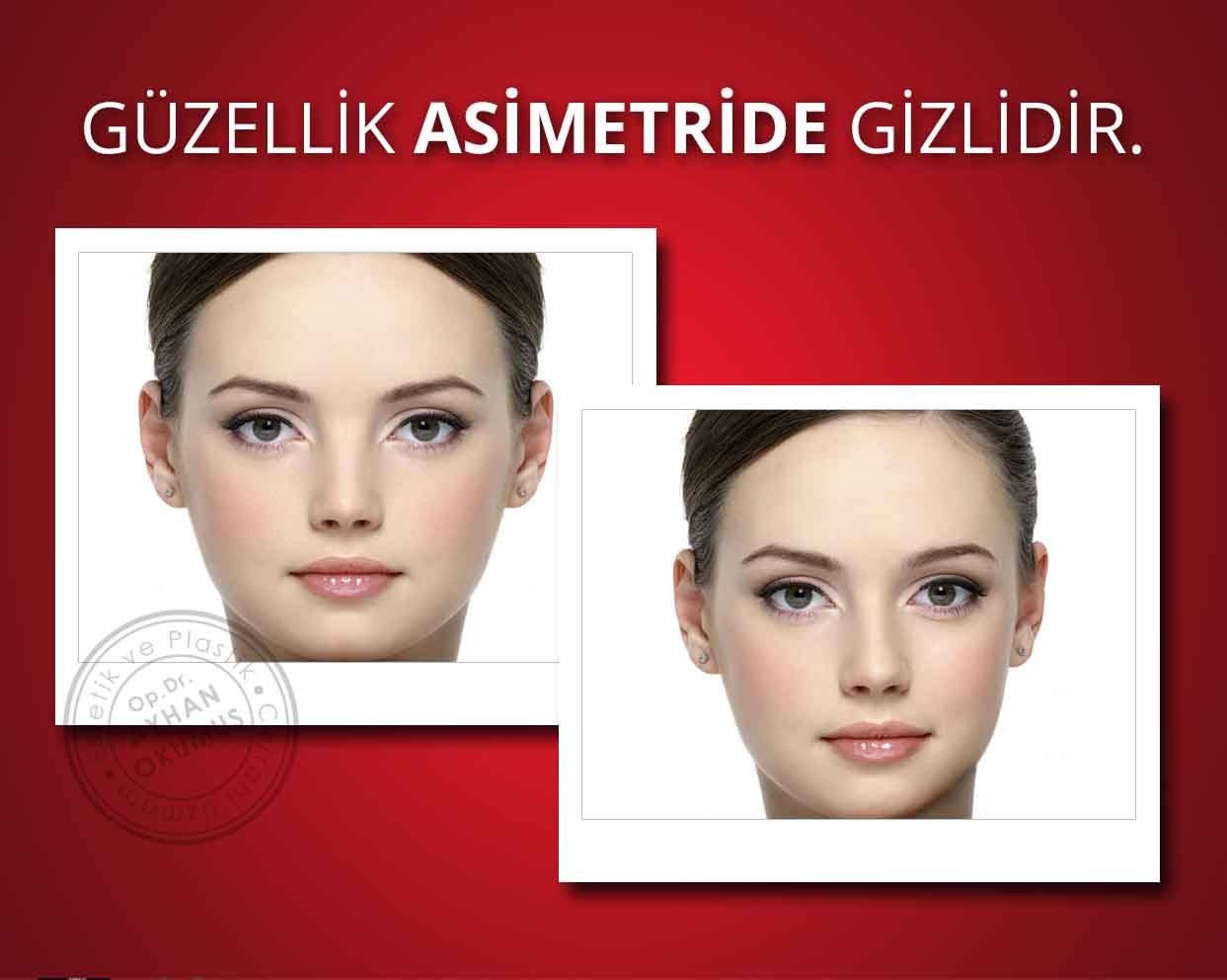 Asimetri