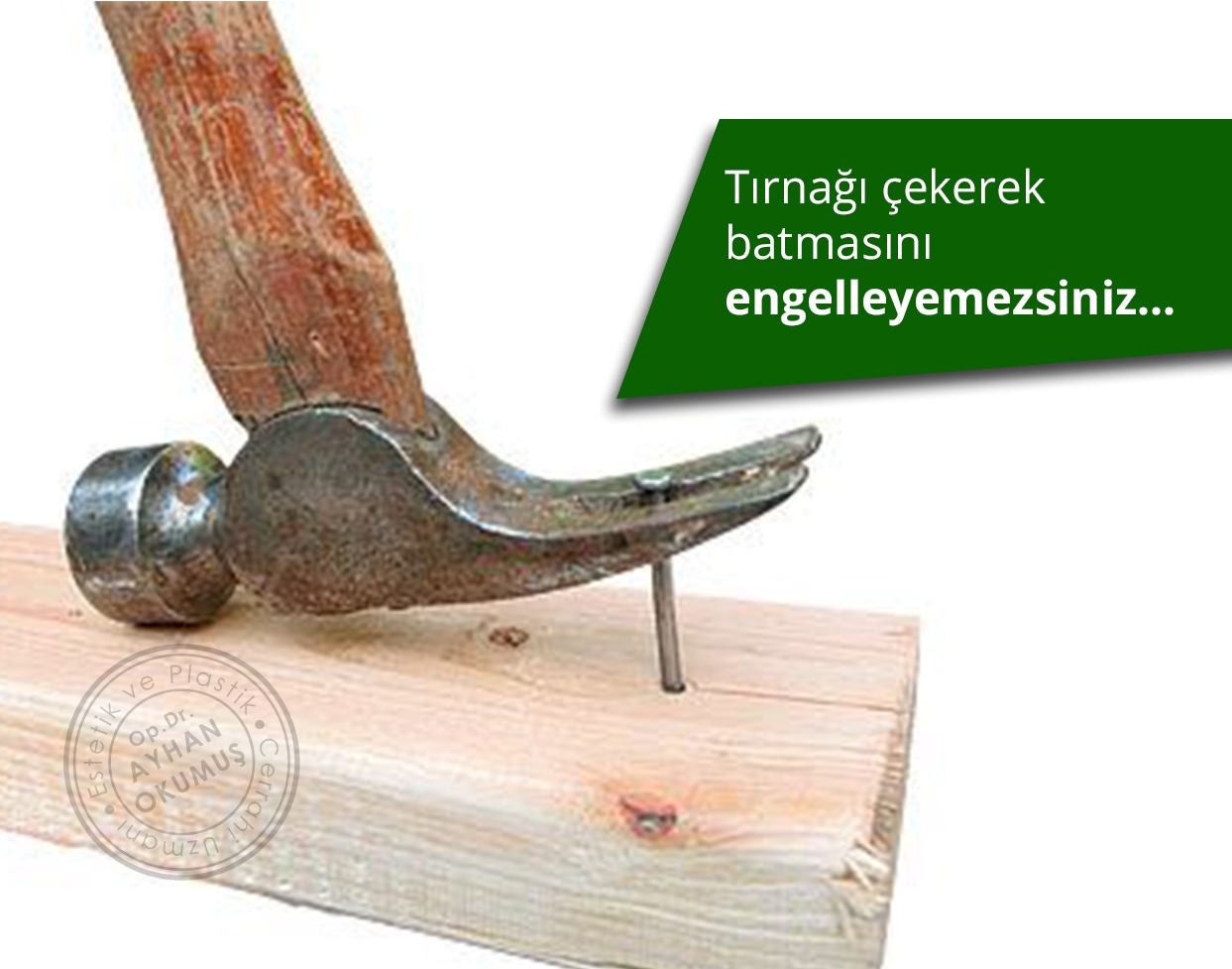 Tırnak Batması