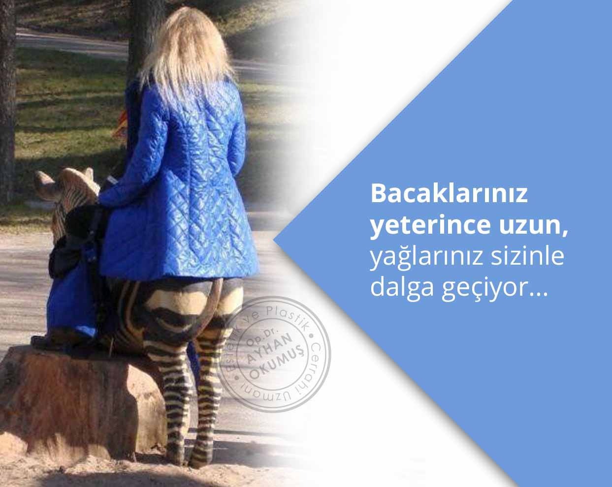Bacak Estetiği