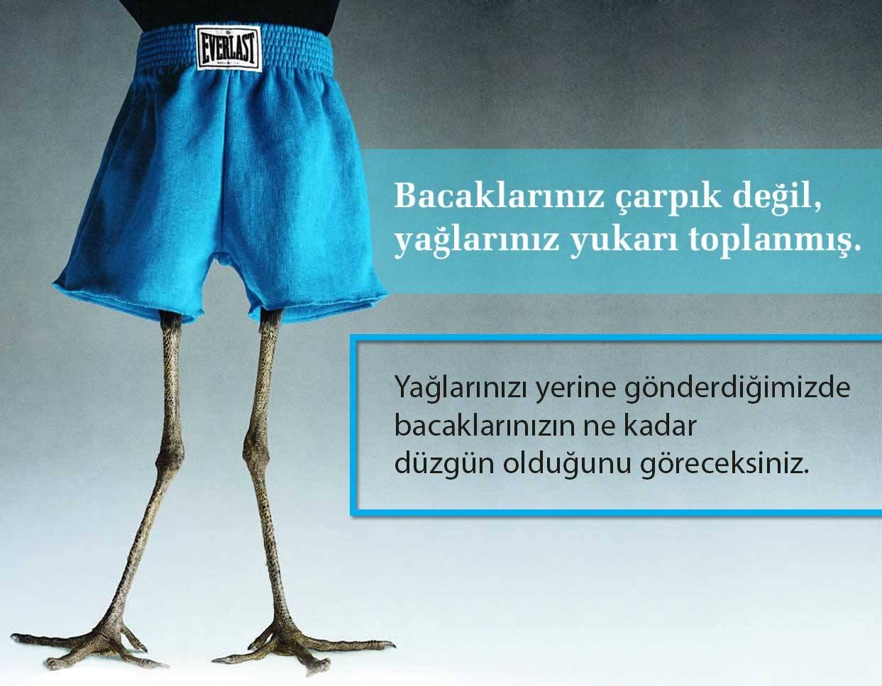 Çarpık Bacak Estetiği