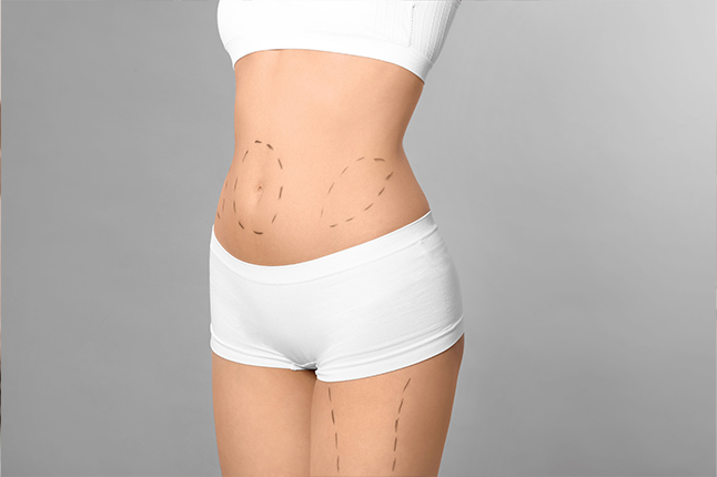 Liposuction ve Yağ Şekillendirme